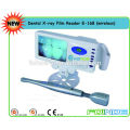 Dental-Röntgenfilm-Leser (Modell: E-168 Wireless) (CE-geprüft) - HEISSES PRODUKT